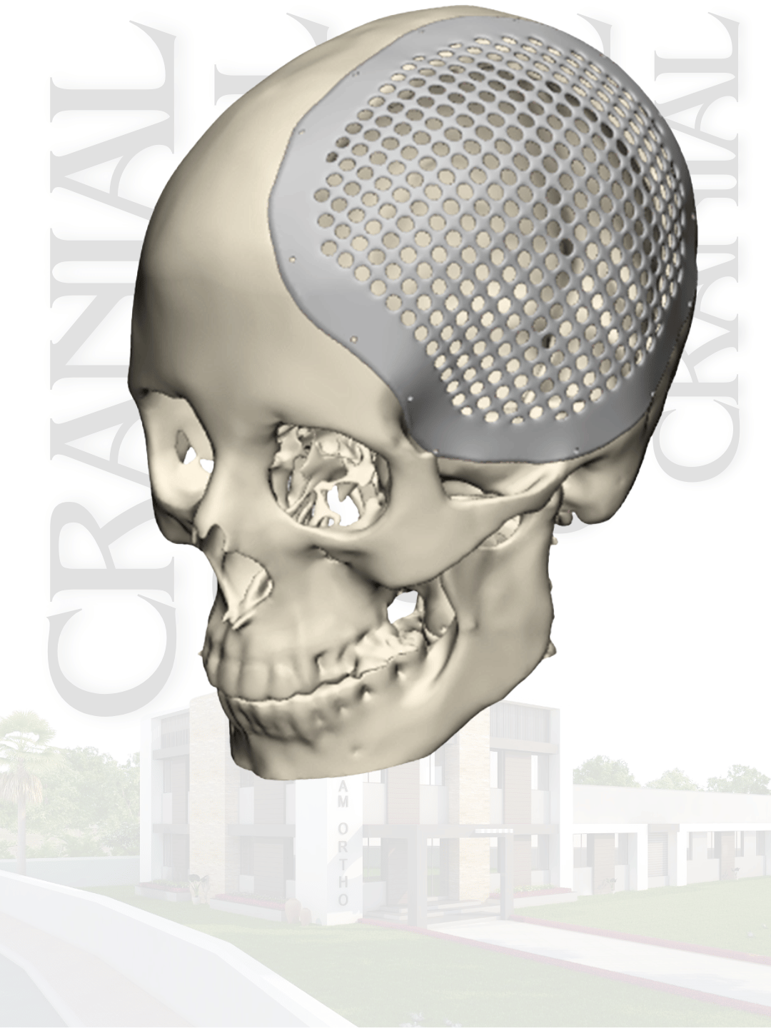Cranio implant and specification presentation