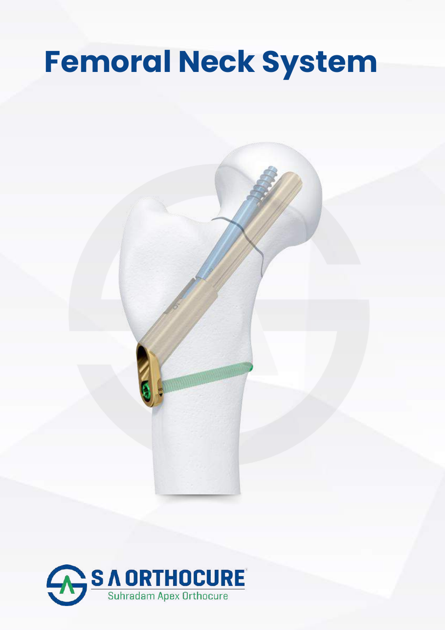 Femoral Neck System product system